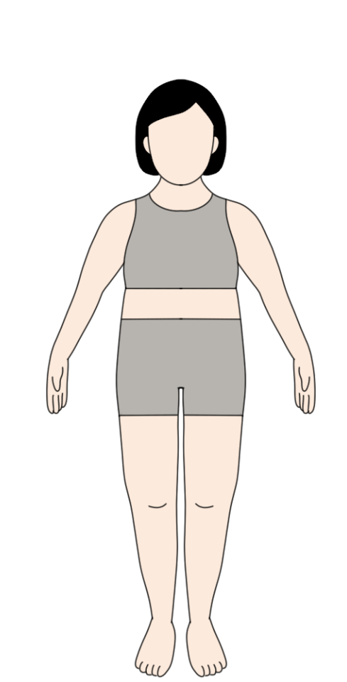 女性BMIの肥満2度