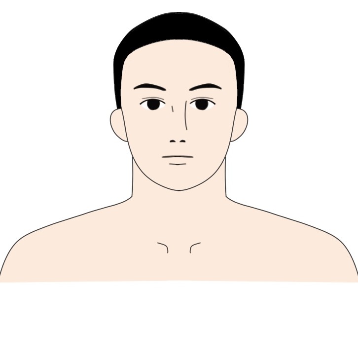 身長160cm体重80kg程度の男性が23kg痩せた顔の見た目の変化アフター
