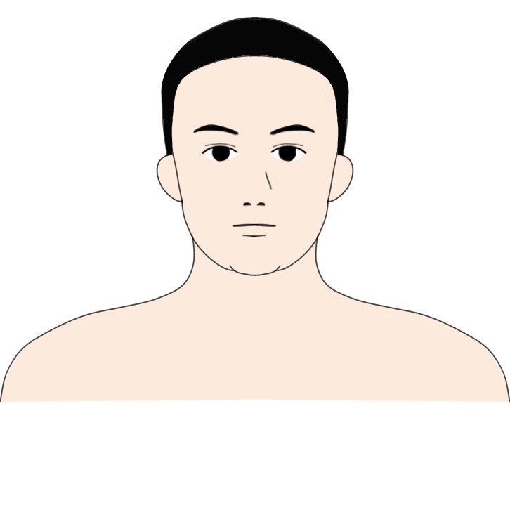 身長160cm体重65kg程度の男性が23kg痩せた顔の見た目の変化ビフォー