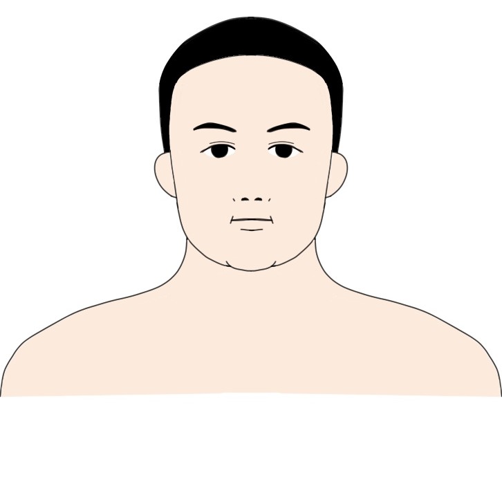 身長160cm体重90kg程度の男性が23kg痩せた顔の見た目の変化ビフォー