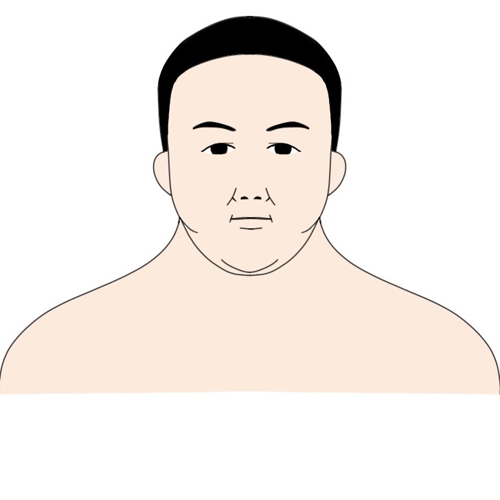 身長160cm体重105kg程度の男性が23kg痩せた顔の見た目の変化ビフォー