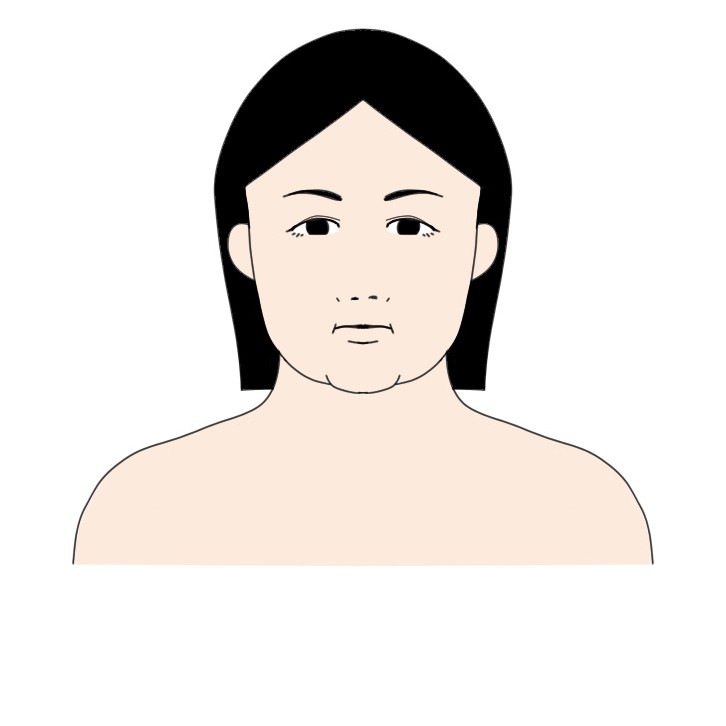 身長150cm体重80kg程度の女性が23kg痩せた顔の見た目の変化ビフォー