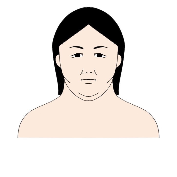 身長150cm体重90kg程度の女性が23kg痩せた顔の見た目の変化ビフォー